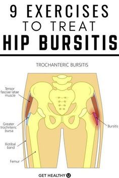 9 Best Exercises For Hip Bursitis (Video Included)