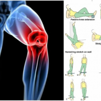 6 Knee Strengthening Exercises For A Meniscus Tear - GymGuider.com